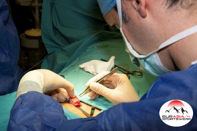 بیماری واریکوسل در مردان