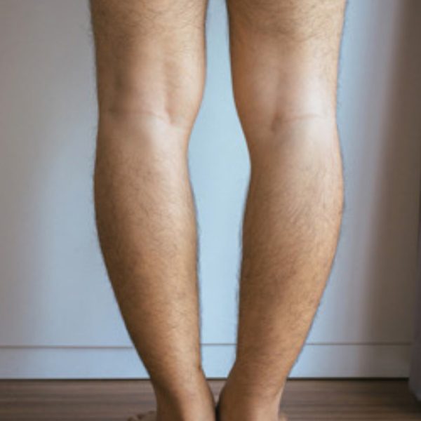 پای پرانتزی